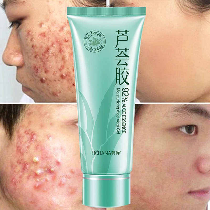 lidah buaya Gel Lidah Buaya Organik, Lidah Buaya 100% Organik dari Daun Lidah Buaya yang Baru Dipoto