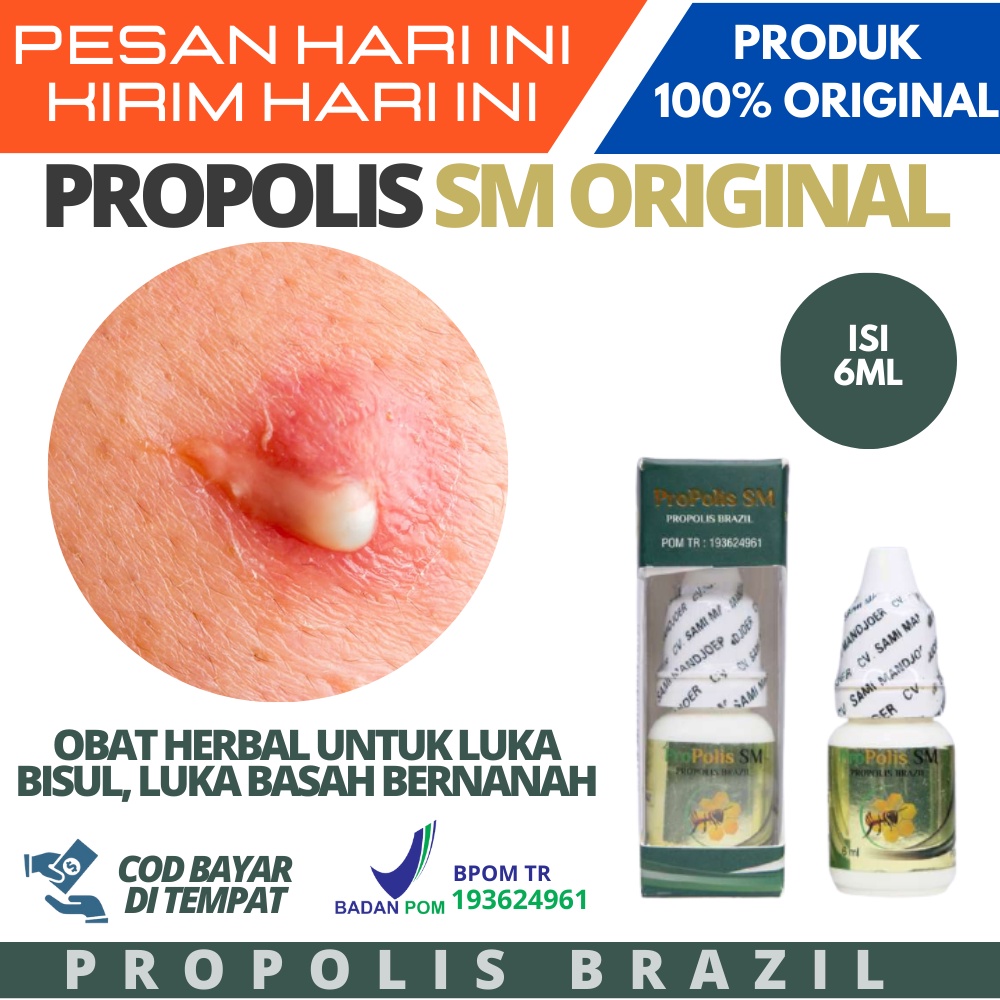 Obat Bisul Herbal, Bisul Bernanah, Bisul Di Tangan, Kaki, Wajah, Kepala, Telinga, Payudara, Betis, B