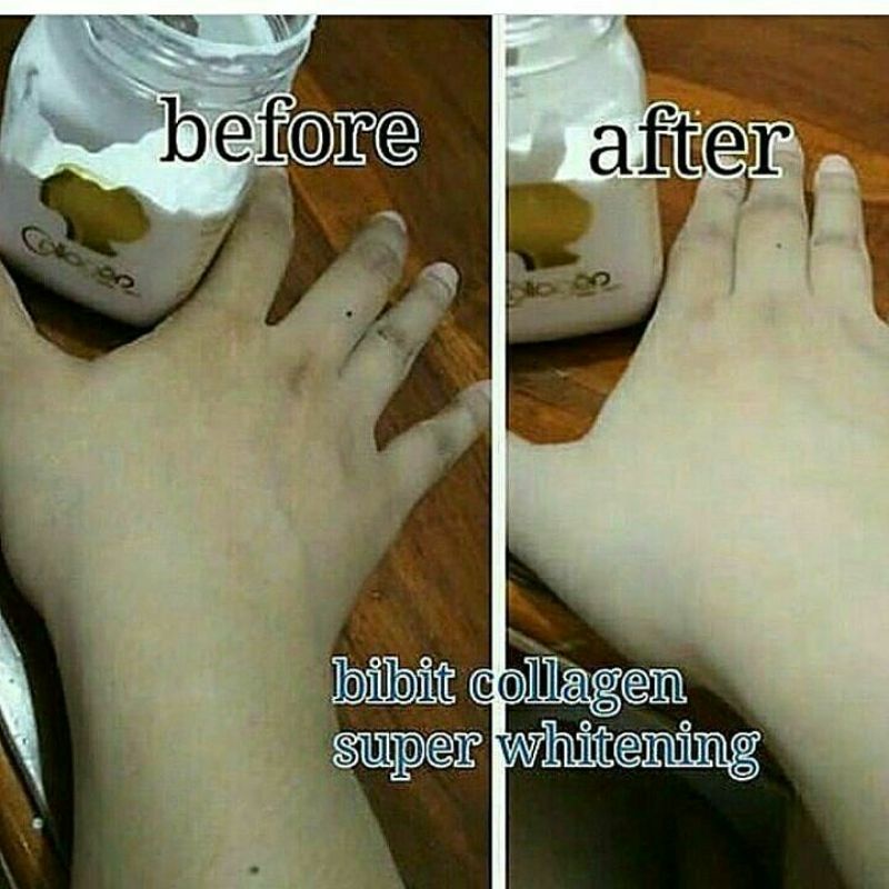 Bibit collagen BPOM By SHCosmetics / bibit colagen by SH cosmetics / bitcol BPOM