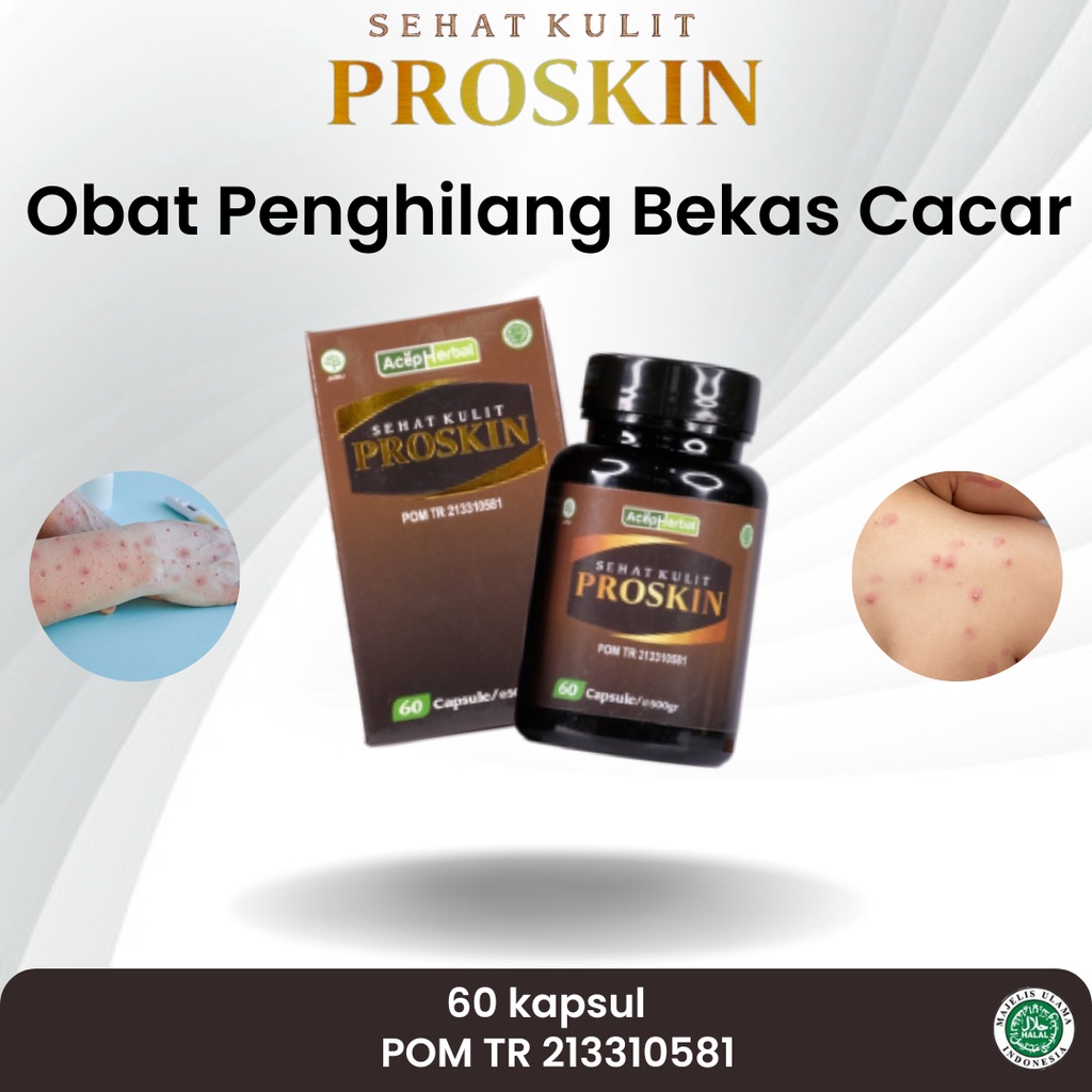 Jual Obat Penghilang Bekas Cacar Cacar Air Cacar Monyet Cacar Api