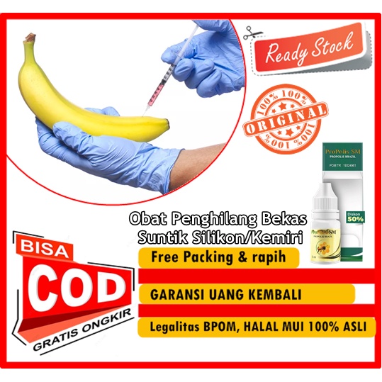 PROPOLIS SM - Obat Penghilang Bekas Suntik Silikon/Kemiri, Obat Pengempes bengkak Akibat Suntik Sili