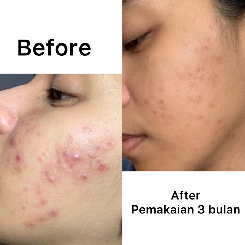 [FREE GIFT] Sabun wajah Jerawat IPPEUNE Glute Soap Bar Regenerist Firming