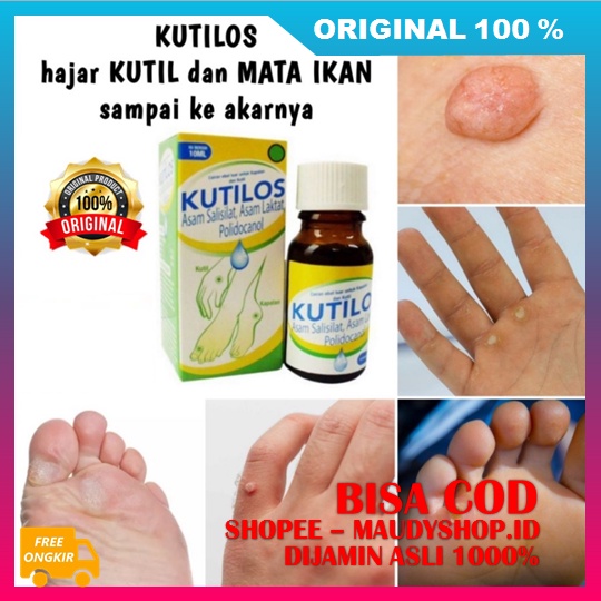 Kutilos Basmi Kapalan, Kutil, Tahi Lalat Dan Mata Ikan Sampai ke Akarnya BPOM ASLI ORI