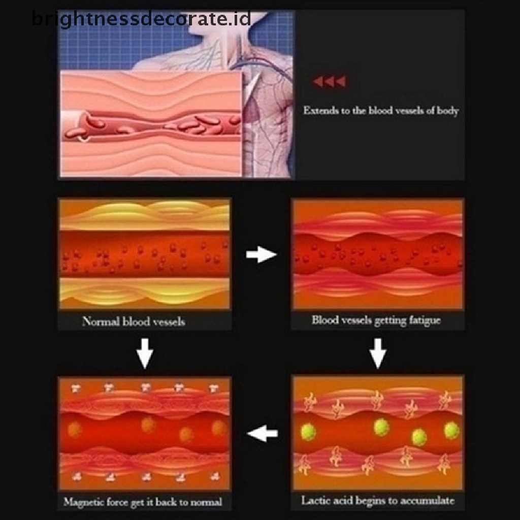 [Birth] 1pasang Anting Tusuk Pelangsing Anting Kesehatan Penurunan Berat Badan Perhiasan Magnetik [ID]