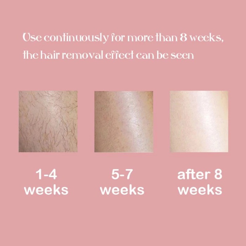 IPL Laser Hair Removal Alat Penghilang Bulu Permanen