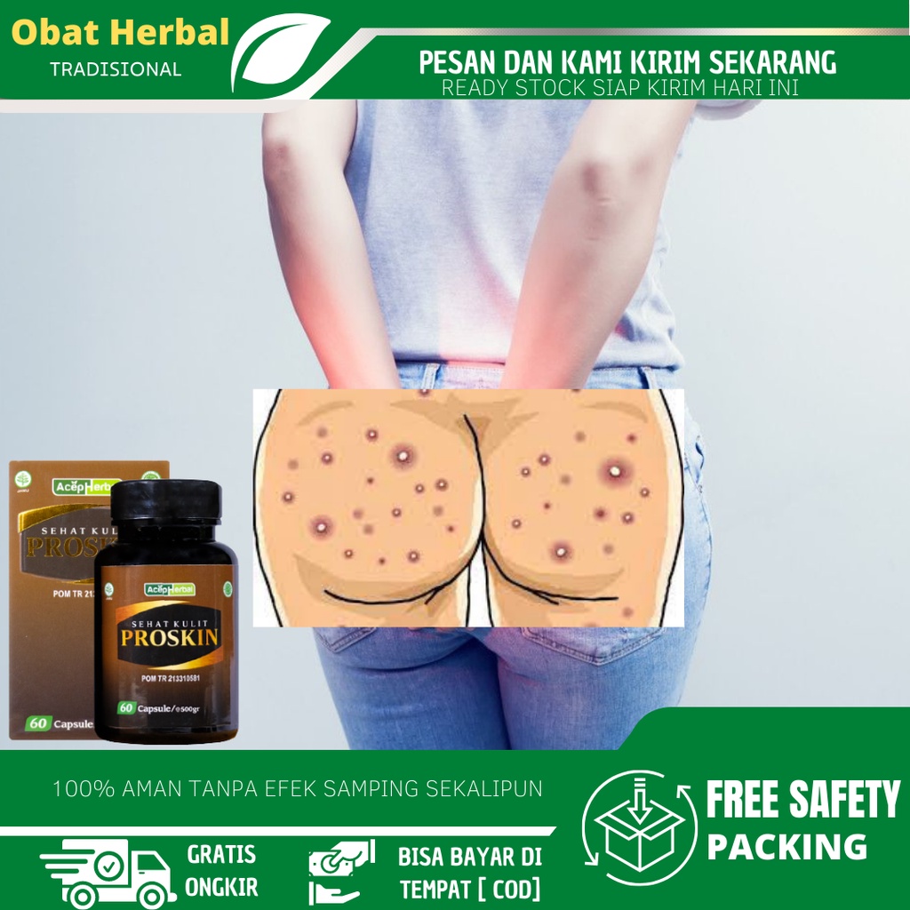 Obat Pantat Burik, Bruntusan di Pantat, Obat Gatal Pantat, Obat Jerawat Pantat, Pantat Hitam Dan Gat