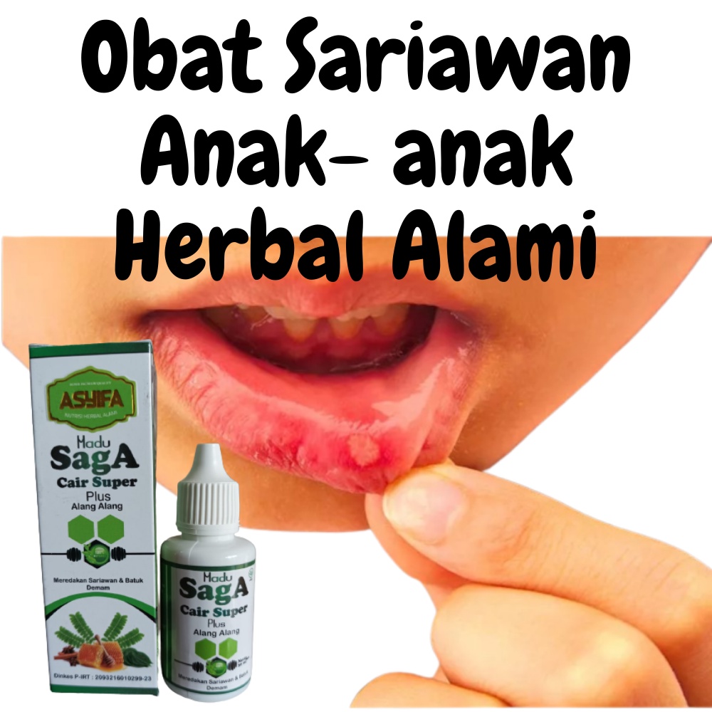 

Madu Saga Obat Sariawan Anak Dan Panas Dalam Plus Alang-Alang / Obat Oles Bibir Sariawan Pecah-Pecah Anak-Anak