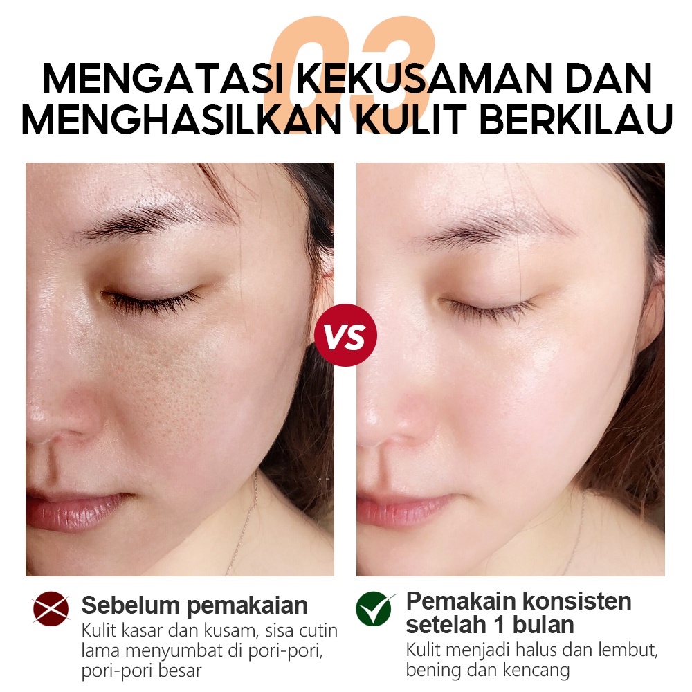 VIBRANT GLAMOUR α-Arbutin Whitening Lotion Toner Serum Cleanser Krim Pencerah Wajah Menghilangkan Bintik Hitam Mengurangi Garis Halus Melembabkan Meregenerasi Perawatan kulit