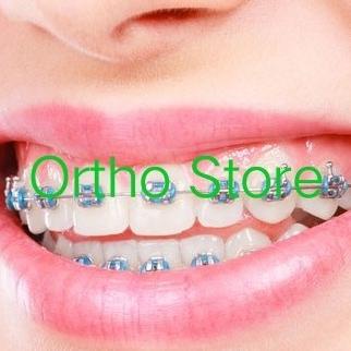 Behel lepas pasang/behel gigi/warna warni/bracket gigi/behel fashion