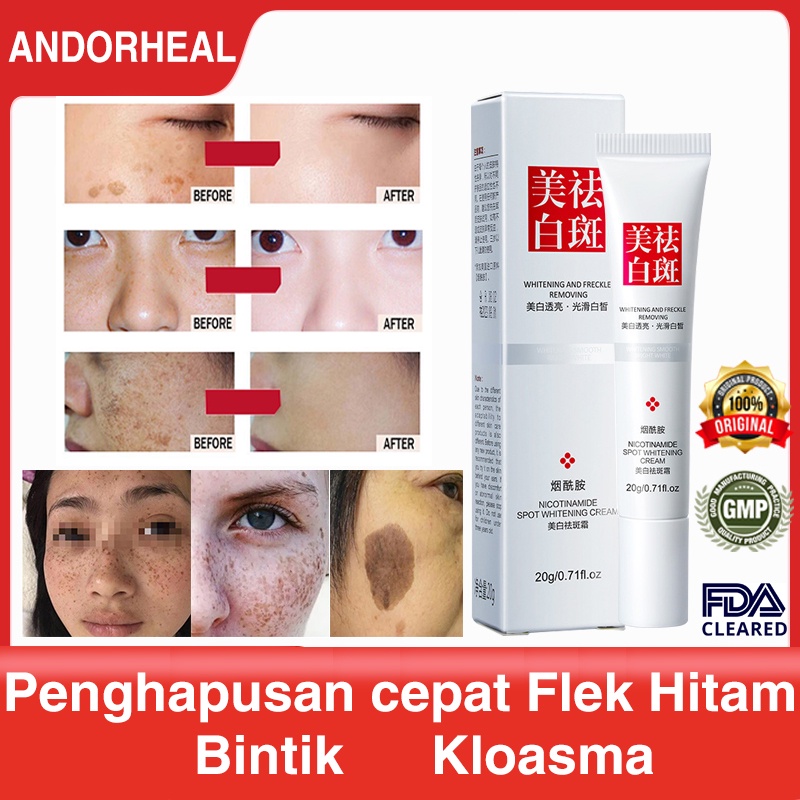 Penghilang flek hitam Night whitening salep flek hitam White neng cream flek hitam penghilang flek hitam di wajah 20g Cream Salep Pemutih Efektif Penghilang Bintik hitam Diwajah Jerawat Dan Bekas Jerawat