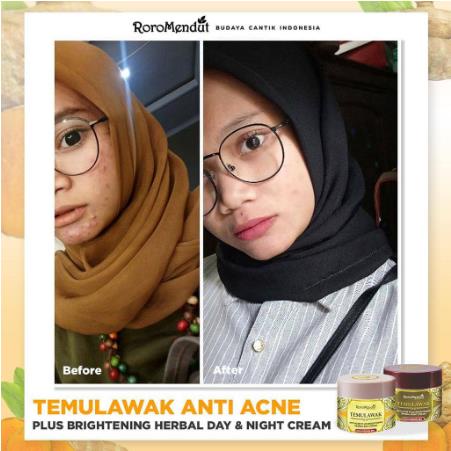 ^ KYRA ^ Roro Mendut Paket Starter Temulawak Day Cream Night Cream Soap Bar Skincare Skin Care