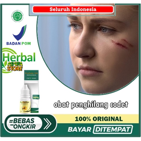 obat penghilang codet, Salep menghilangkan codet yang sudah lama, obat penghilang codet di wajah, me