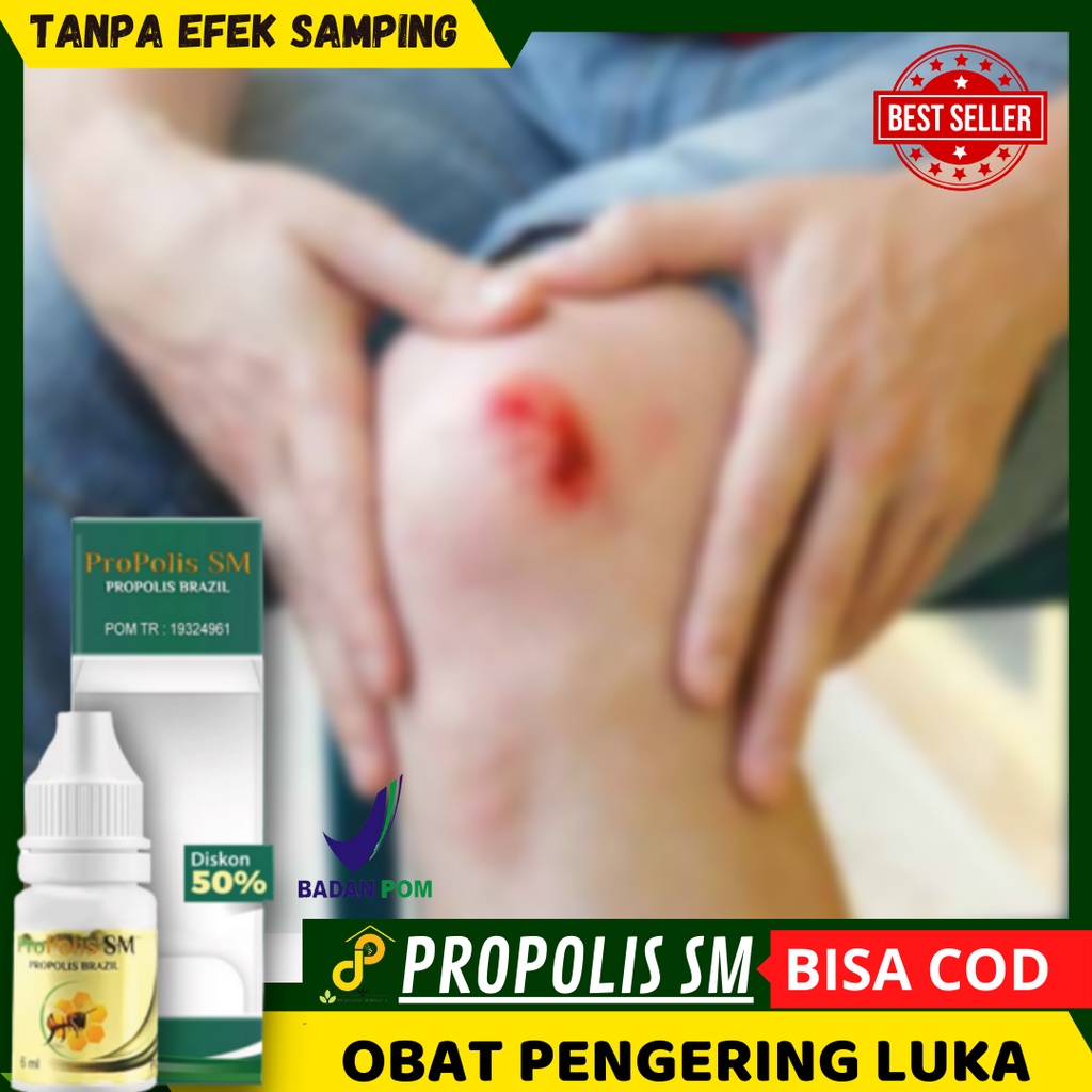obat luka biar cepat kering - Salep Pengering luka infeksi - luka bernanah, luka budug, luka koreng,