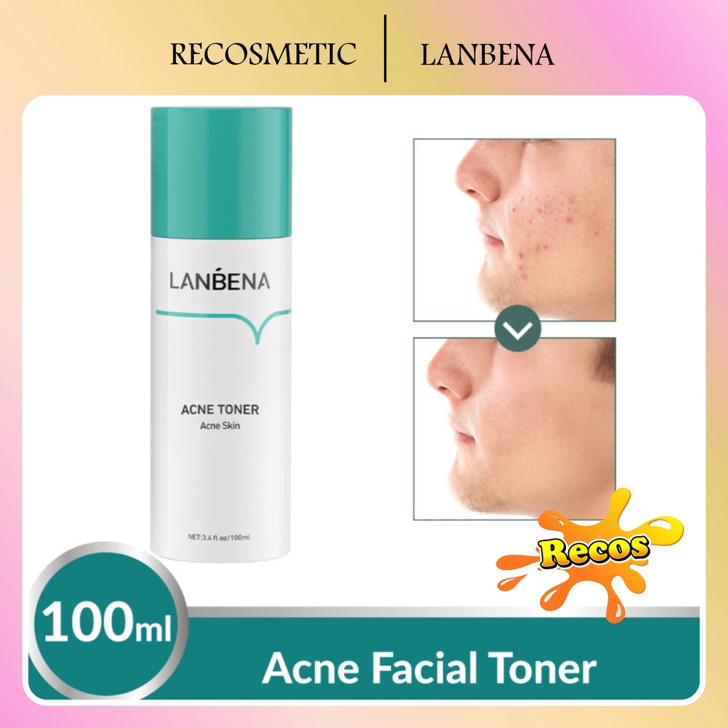 LANBENA Acne Facial Toner - Wajah Berjerawat Melembabkan Mengobati jerawat Pore Refining Smoothing Serum Acne [BPOM]