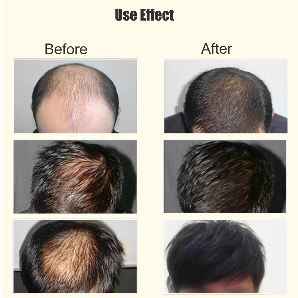 Serum penumbuh rambut jahe nutrisi semprot anti rambut rontok 30ml spray jahe nutrisi semprot jahe akar rambut semprot pelembab rambut.