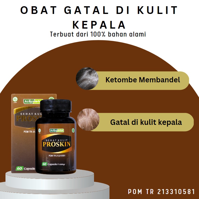 Jual Kaka Herbal Obat Ketombe Parah, Obat Kepala Borok, Obat Kulit