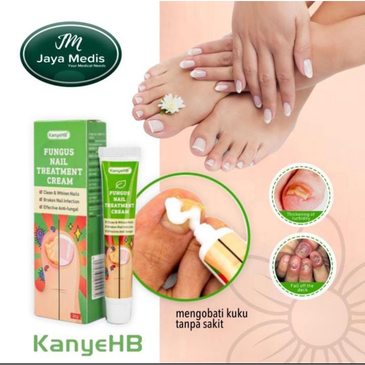 CREAM PERAWATAN KUKU RUSAK - FUNGUS NAIL TREATMENT KENYE HB