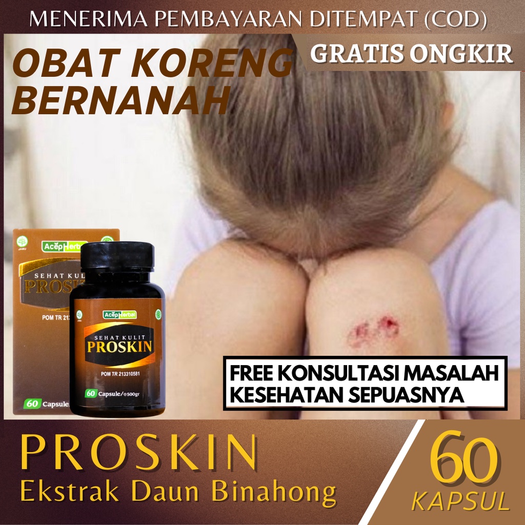 Obat Koreng Bernanah Anak Untuk Menghilangkan Luka Korengan di Kaki Penghilang Gatal Budug Santri Ce