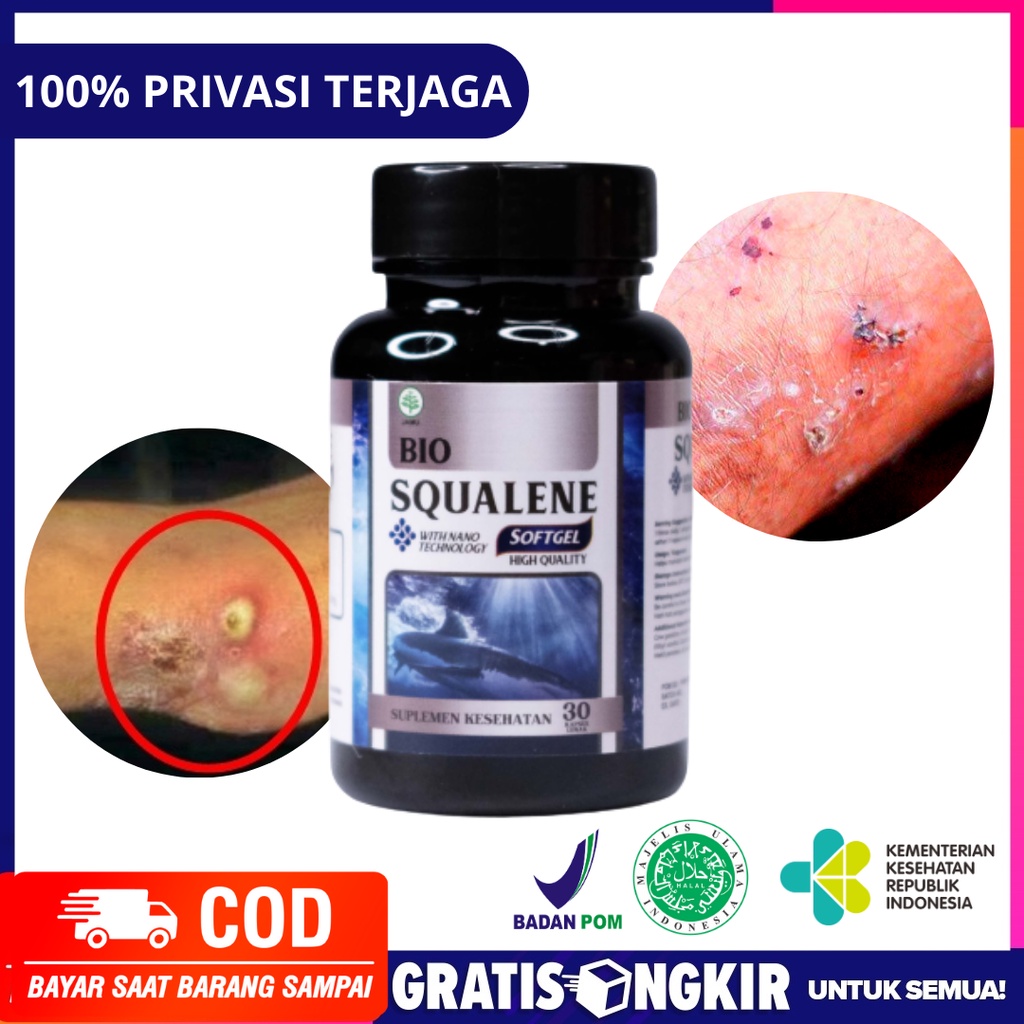 Budugan - Budug Anak - Budug Dewasa - Gatal Budug - Budug Bernanah - Kaki Budug - Penyakit Budug - B