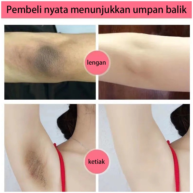 Pemutih selangkangan ketiak Lotion pemutih tubuh Underarm Whitening cream Perawatan kewanitaan tubuh 60G Efektif memutihkan leher/tangan/kaki/miss v/Selangkangan/ ketiak/Aman dan tidak berbahaya 100% asli