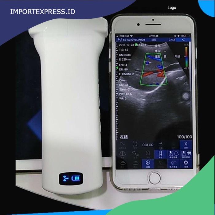 GT Alat Usg Hewan Wireless Ultrasound WIFI Android/IOS Windows - Sonar Scanner, UK PLUG