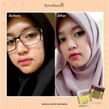 ^ KYRA ^ Roro Mendut Paket Starter Temulawak Day Cream Night Cream Soap Bar Skincare Skin Care