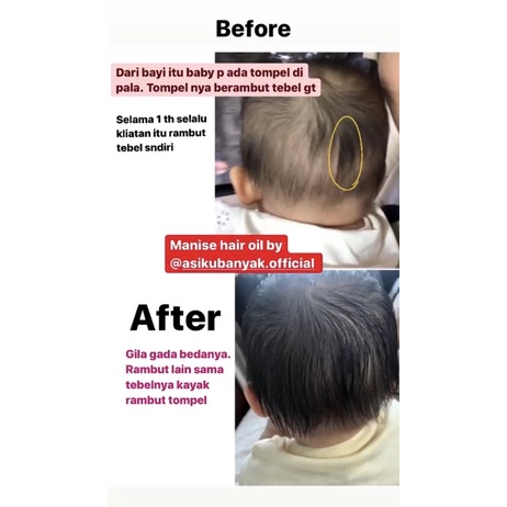 Manise hair oil for baby and dewasa hair oil serum tonic penumbuh rambut rontok botak hair fall hair