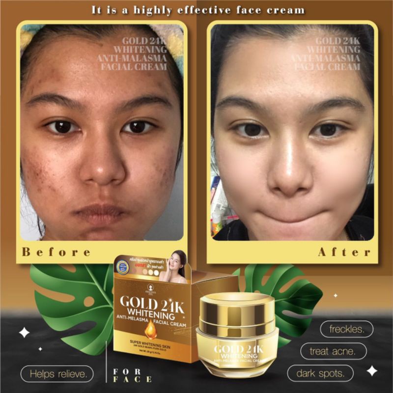 PRECIOUS 24K GOLD WHITENING ANTI MELASMA FACIAL Dengan Emas 24K