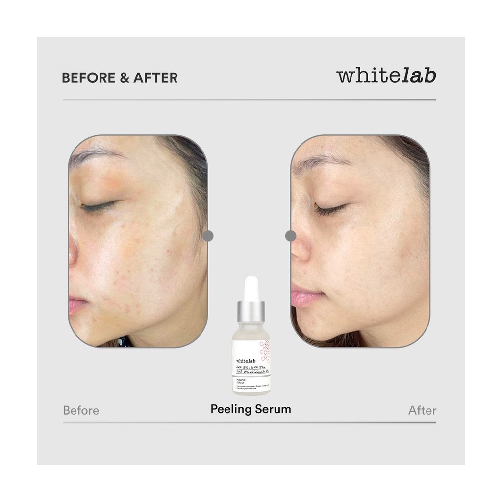 [BPOM] Whitelab Peeling Serum AHA BHA