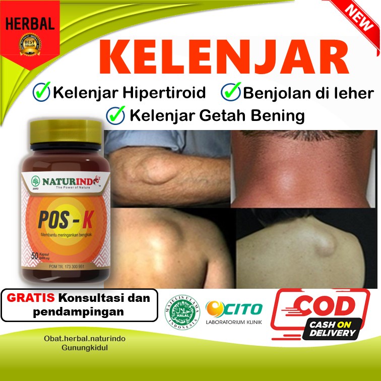 Jual Obat Kelenjar Getah Bening Di Leher Tiroid Lipoma Di Tangan