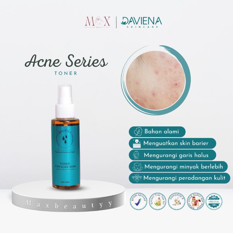 Daviena Skincare Toner Acne Series