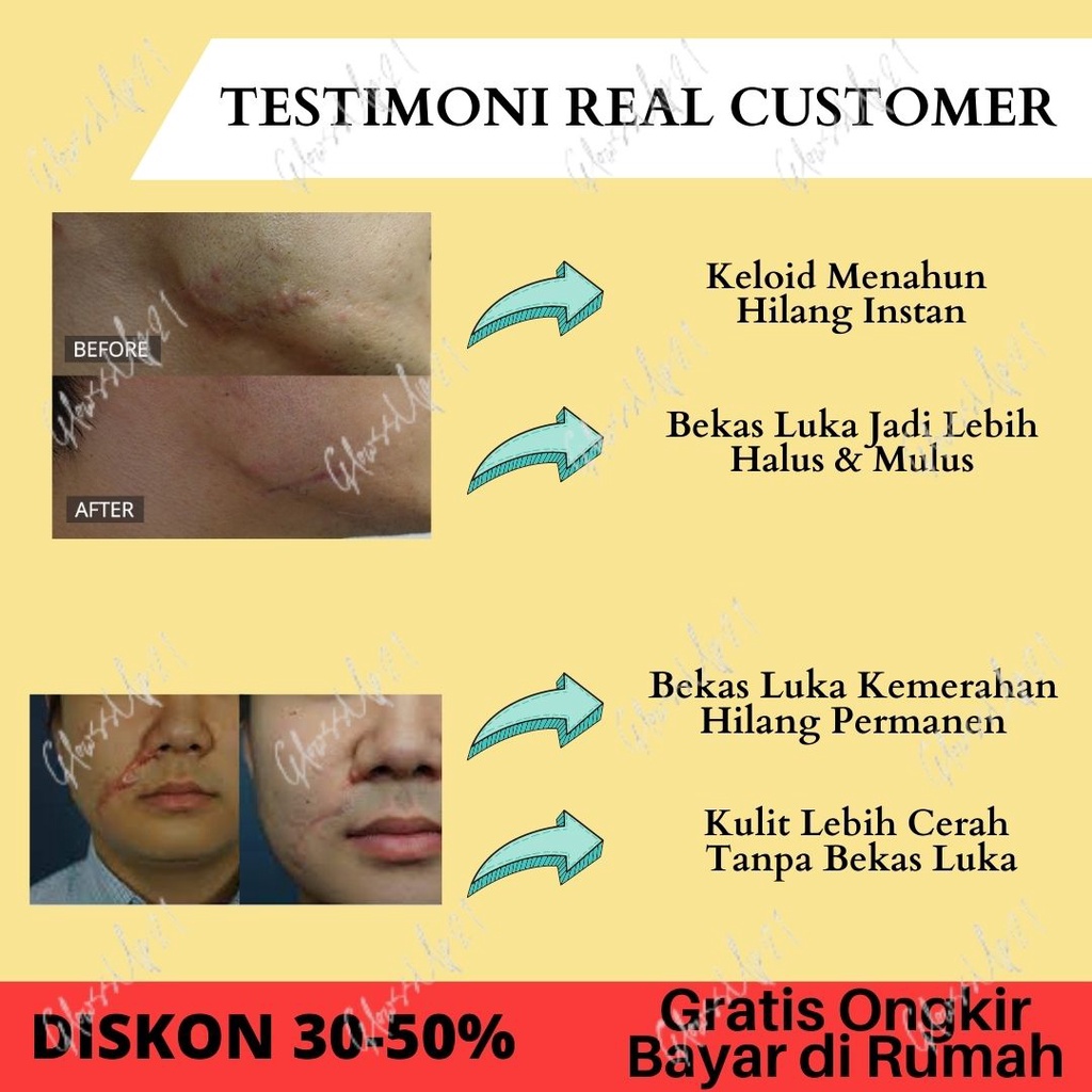 BIO OIL STRETCH MARK PENGHILANG BEKAS LUKA BIO HERBAL BEAUTY OIL 75ML