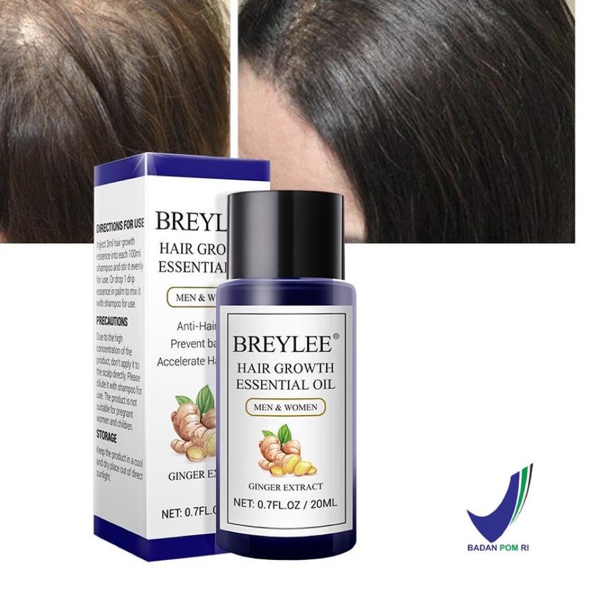 ✤ [] BREYLEE Hair Growth Essential Oil 20ml (Serum Penumbuh Rambut - Mencegah Kerontokan) ➢