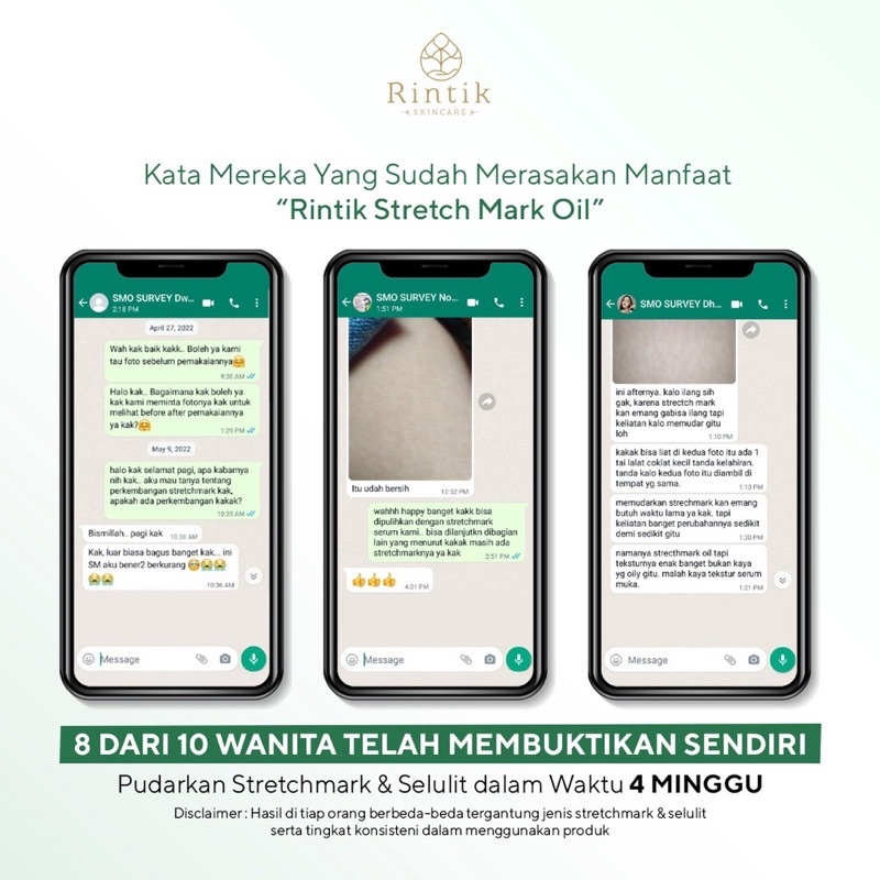 PROMO SIAP KIRIM‼️ Stretch Mark Selulit Oil By Rintik Skincare Pemudar Stretch Mark ALEYA STRETCH MARK