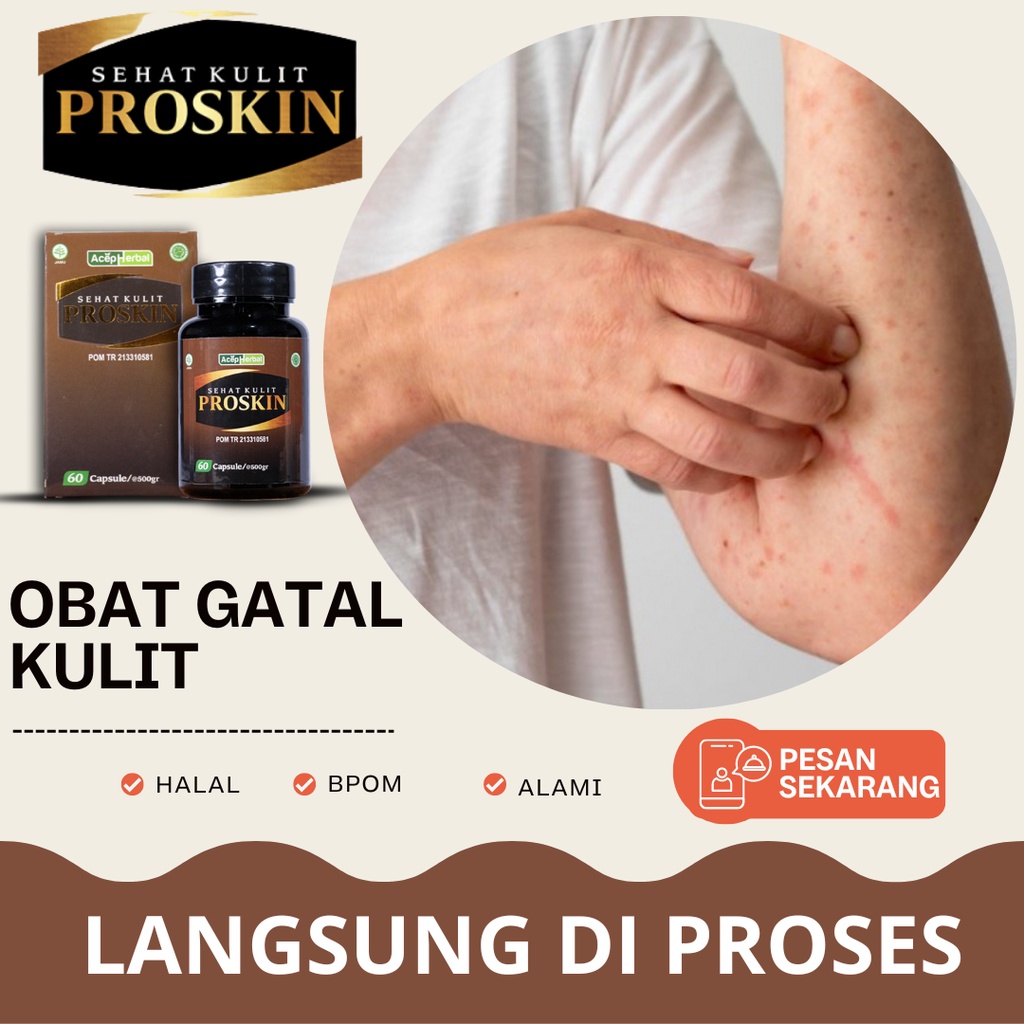 Jual Obat Penyakit Kulit Gatal Alergi Biduran Panu Kadas Kurat Biang Keringat Kaligata Eksim