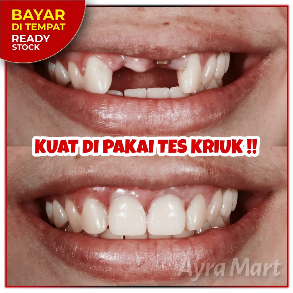 SUPER KUAT  Gigi palsu lepas pasang 1set orang dewasa ko Ggi palsu penutup ompong atas bawah Gigi pa