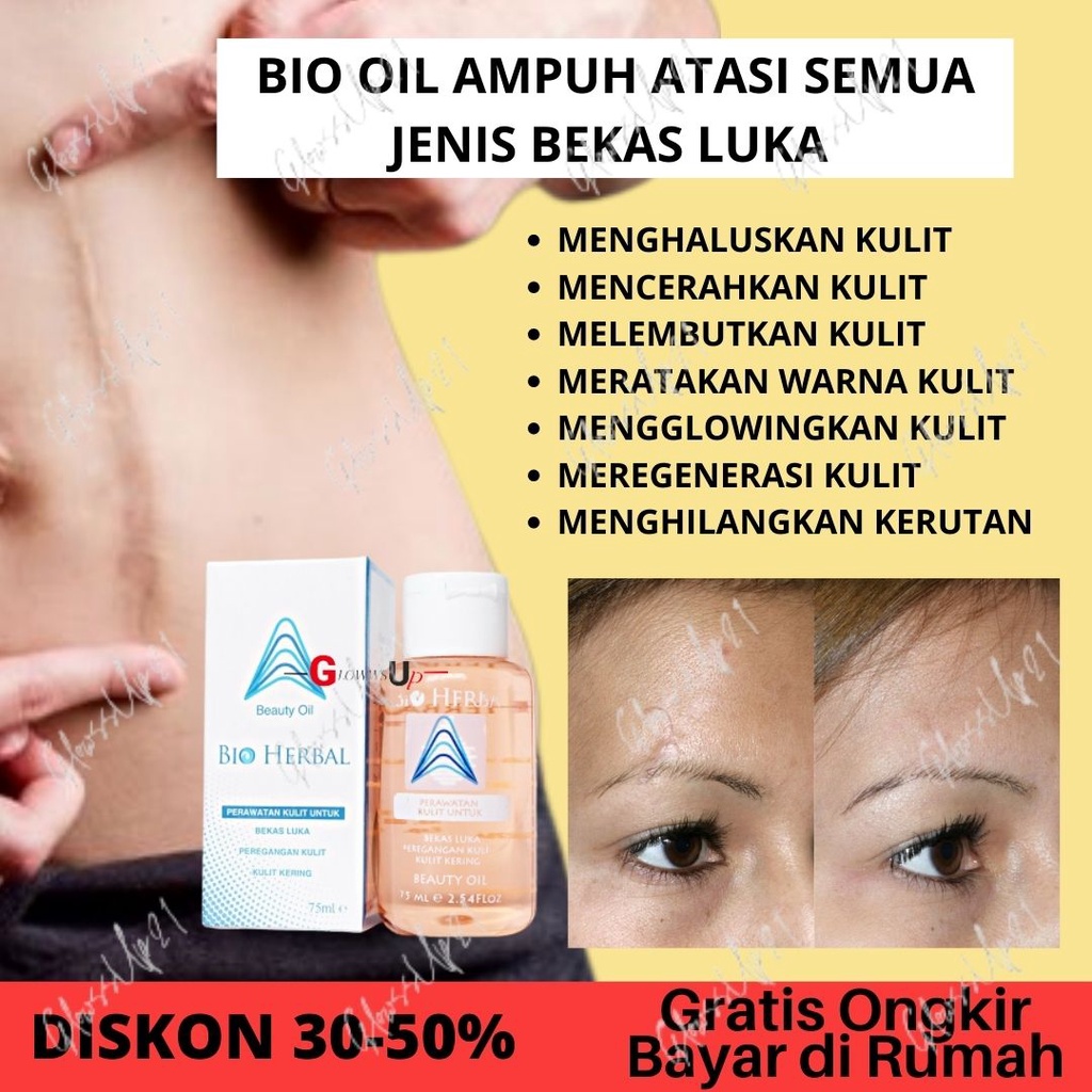 BIO OIL STRETCH MARK PENGHILANG BEKAS LUKA BIO HERBAL BEAUTY OIL 75ML