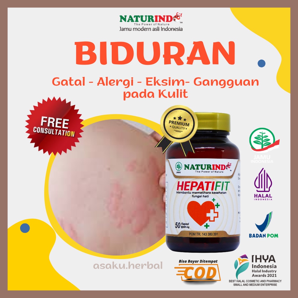 Obat Biduran Obat Gatal Kulit Gatal Alergi Dingin Alergi Kulit Gatel Eksim Bentol Exim Obat Alergi