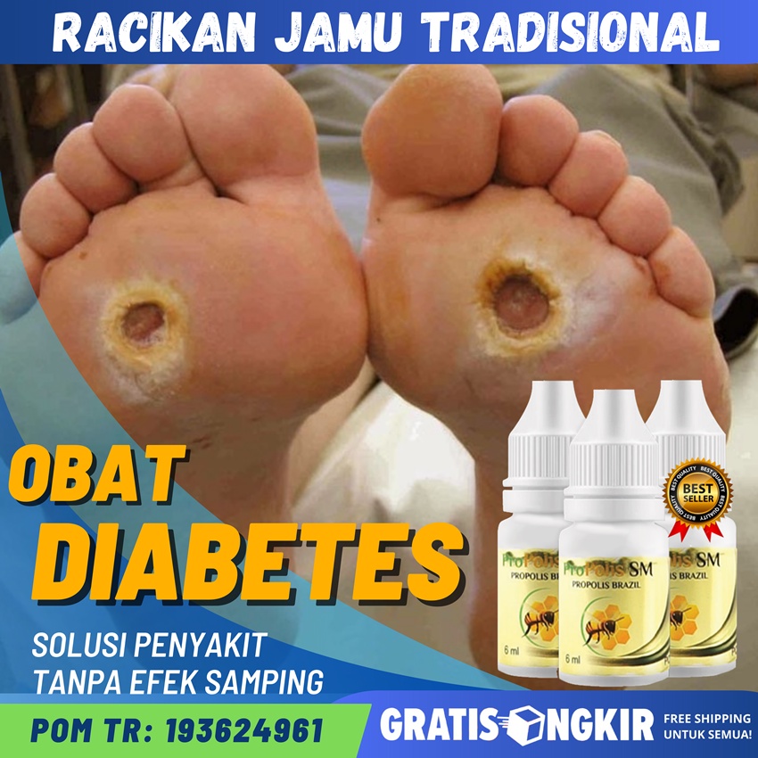 Jual Obat Diabetes Gula Darah Tinggi Diabetes Kering Diabetes Basah