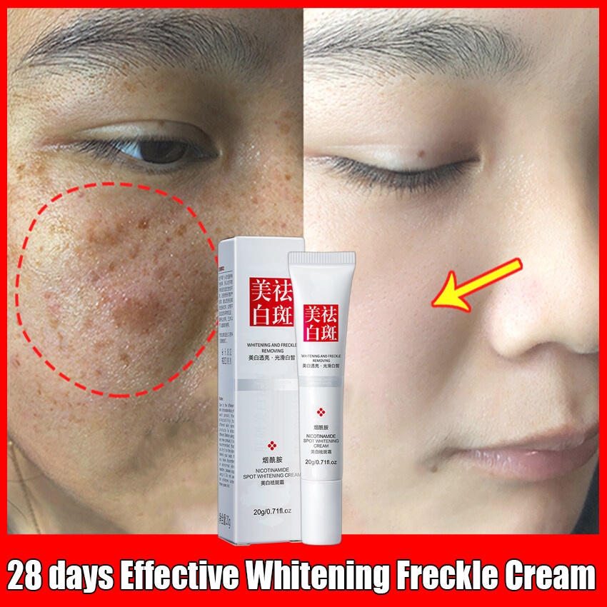Cream penghilang flek krim pemutih Penghilang flek hitam di wajah hitam  krim penghilang flek  20G menghilangkan flek hitam whitening  freckle cream Moisturizing，Whitening, Dark Spots Remover Brighten Skin Anti-Aging