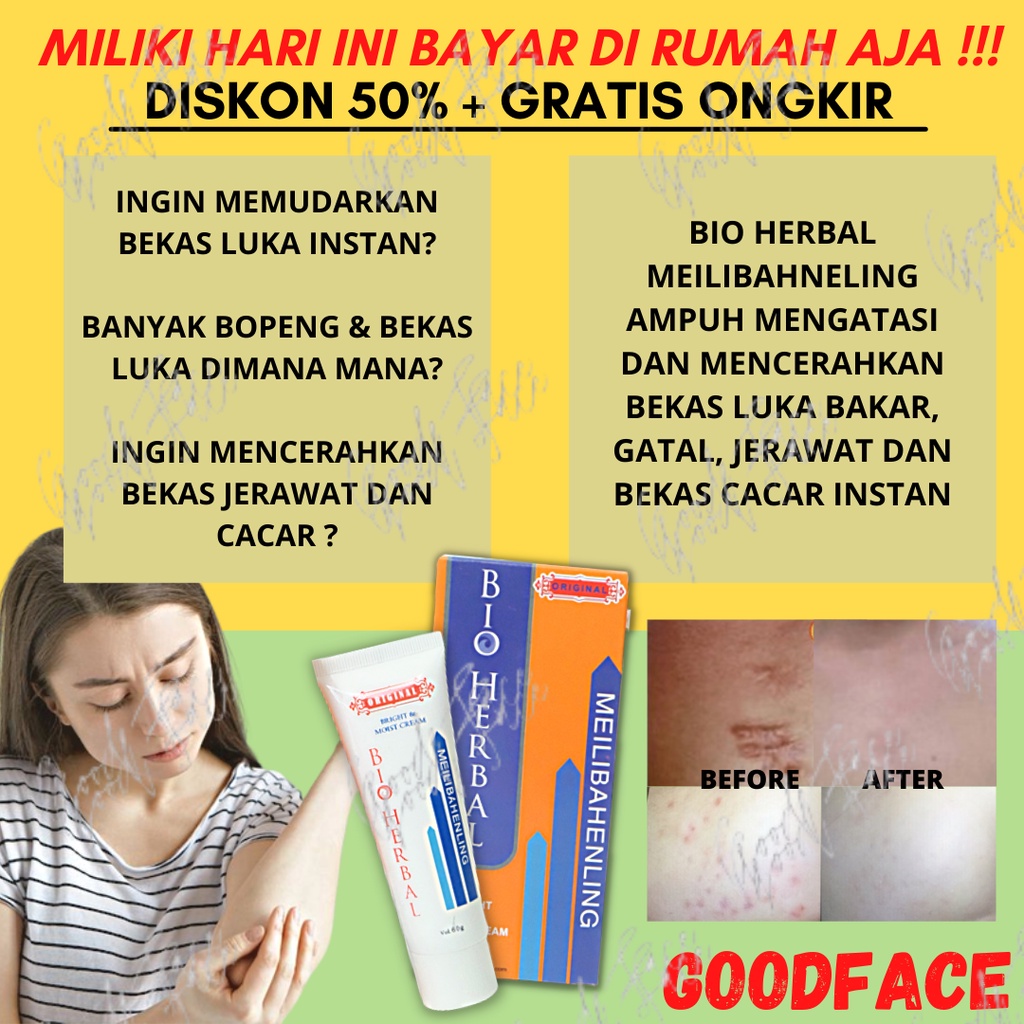 BIO HERBAL MEILIBAHENLING - SALEP PENGHILANG BEKAS LUKA - PENGHILANG BOPENG