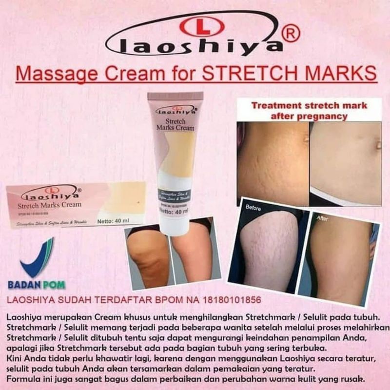 LAOSHIYA STRETCH MARKS CREAM / LAOSHIYA MASSAGE CREAM