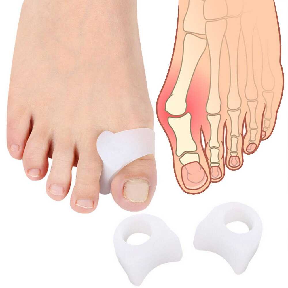 Sumifun Sleeve Korektor Tulang Jempol Hallux Valgus Orthotics