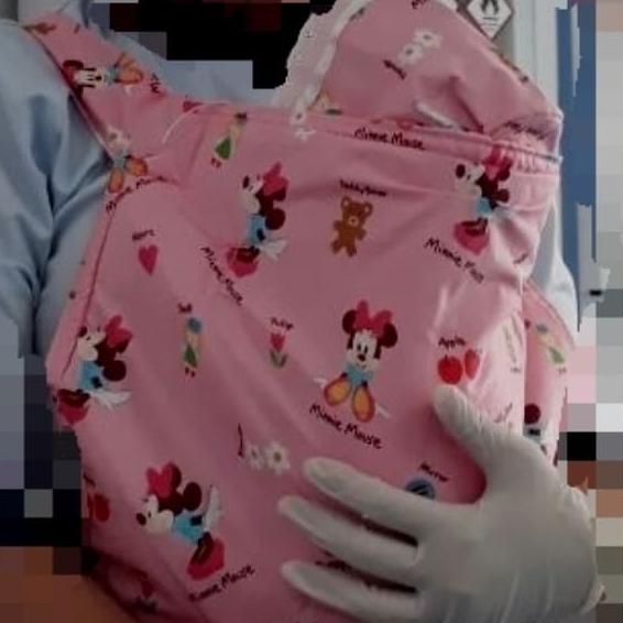 gendongan kangguru (metode kangguru bayi prematur)