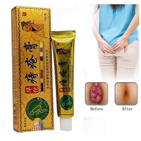 Original  Obat Salep Wasir/ CREAM Obat Wasir Herbal Cina / Salep Krim Yang Ampuh Mengatasi Ambeien/ 