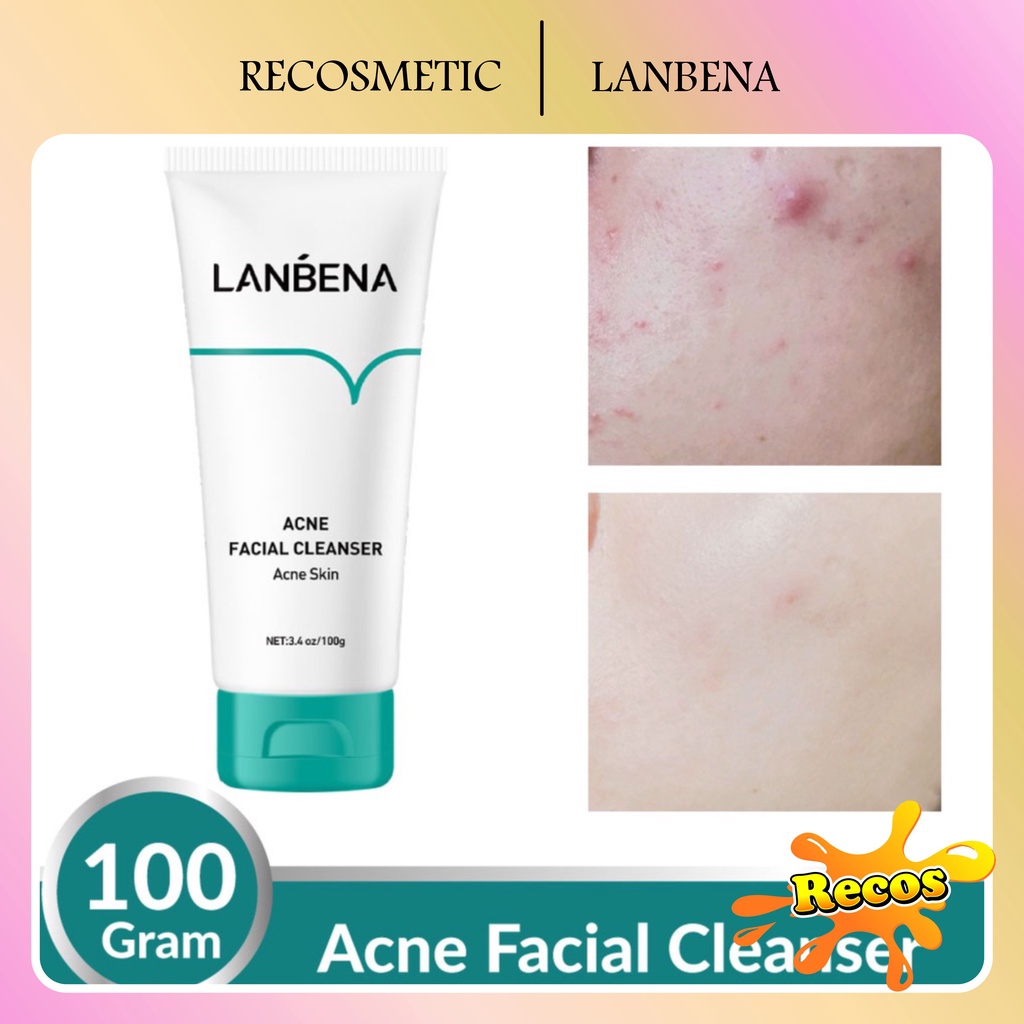 [BPOM] LANBENA Acne Facial Cleanser - Wajah Berjerawat (100 gr)