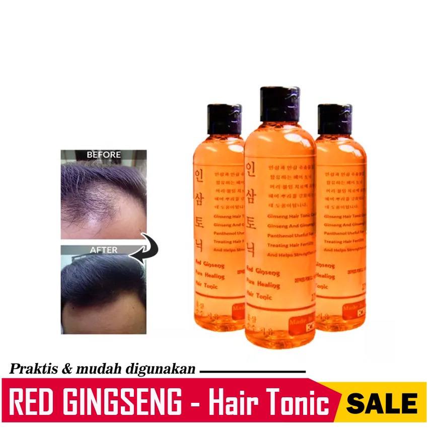 RED GINSENG KOREA HAIR TONIC ORIGINAL / PENUMBUH RAMBUT BOTAK