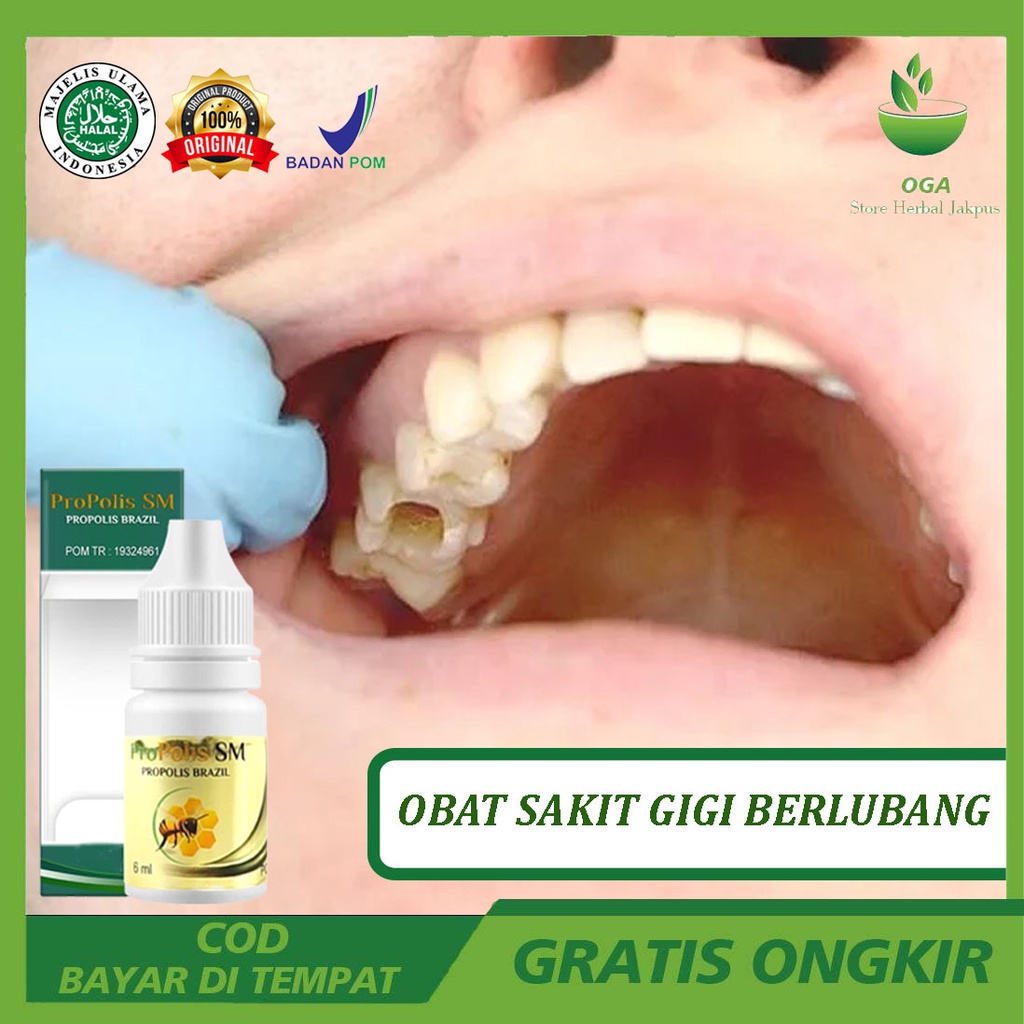 Jual Obat Sakit Gigi Berlubang Bau Mulut Tak Sedap Sariawan Gusi