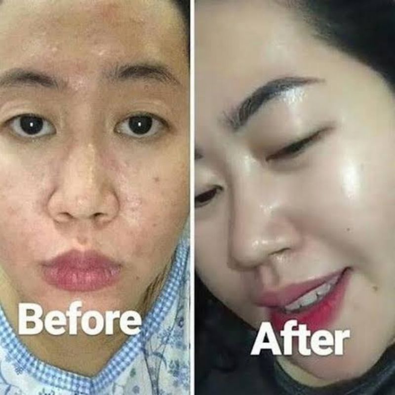 ELCY BEAUTY ORIGINAL LC BEAUTY PAKET GLOWING FLEX &amp; ANTI WAJAH MERAH