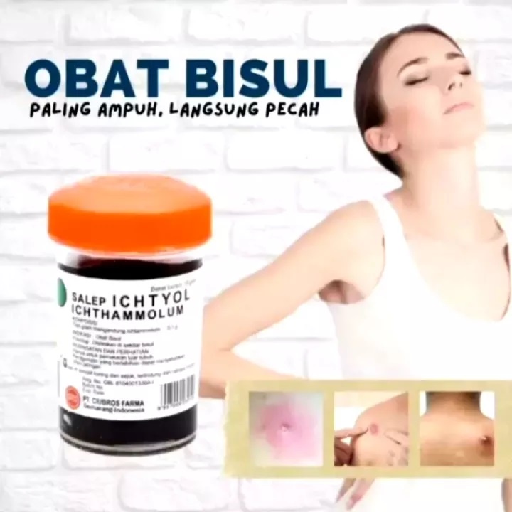 Salep Ichtyol Hitam Salep Bisul 15 Gram